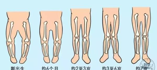 所以,通常新生儿的双腿看着都是有点弯曲的.